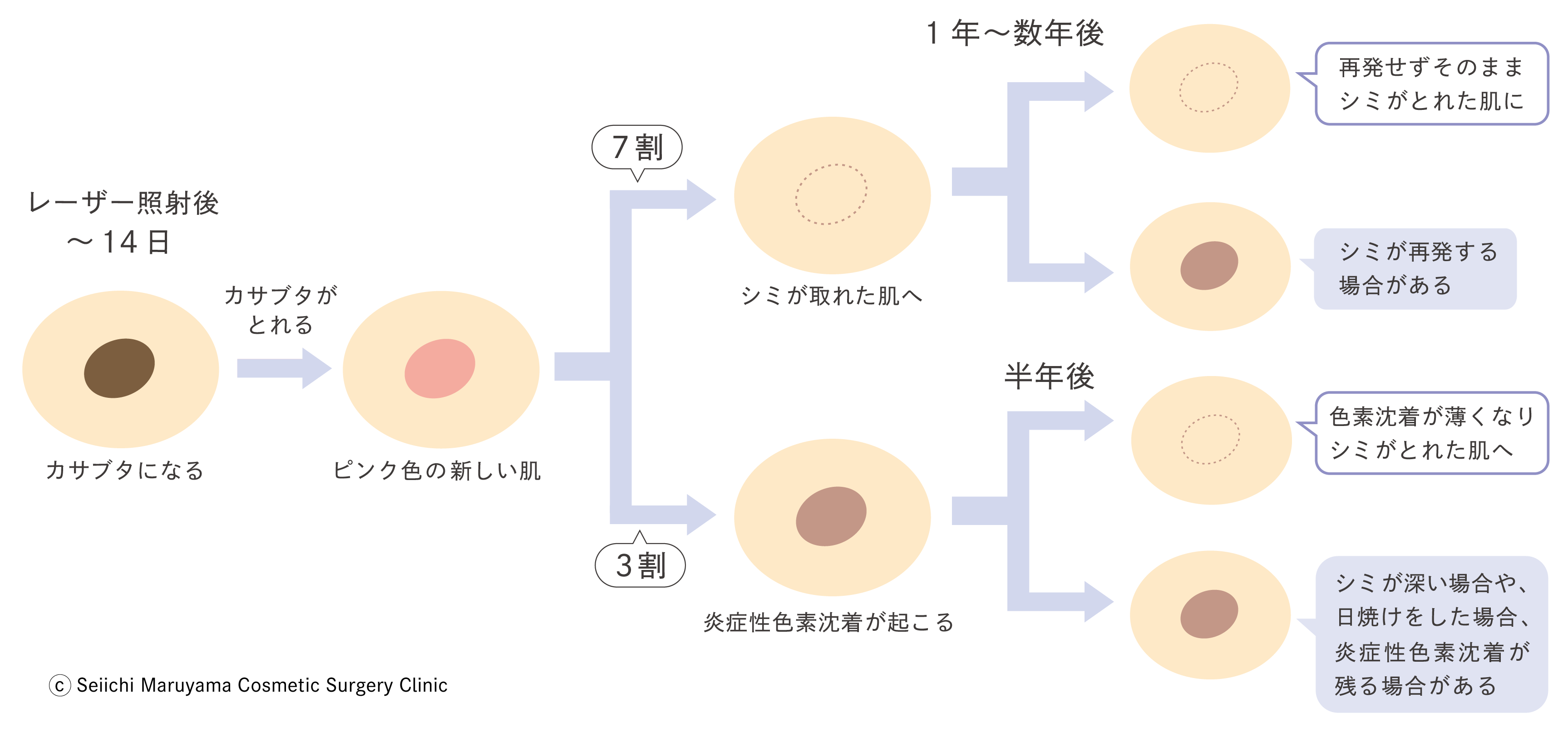 シミが取れる経過図